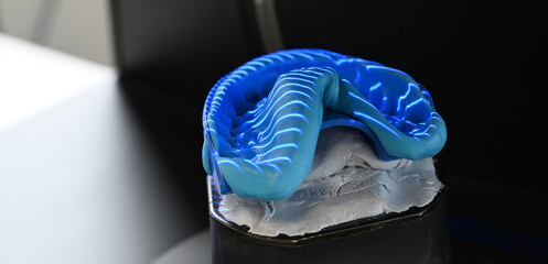 Teeth impression in a 3D scan technology Scanner for dental prosthesis © JOE LORENZ DESIGN