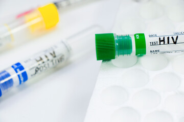 Hiv and aids infection test, doctors face and hand holding tube with blood on the blue background.