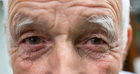 Old man eyes