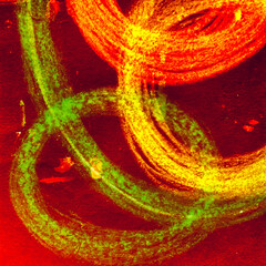 Cancer Cells Transparent. Virus Space Genetic
