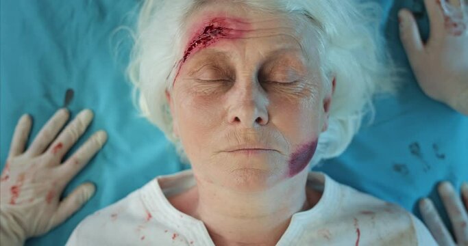 Top view of mature woman with blood and head wound riding with paramedics to hospital. Close up of injured old lady lying on medical transportation cart in ambulance. Concept of healthcare