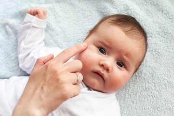 Baby with atopic dermatitis getting cream put. Care and Prevention Of Eczema.