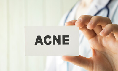 Doctor holding a card with text ACNE medical concept