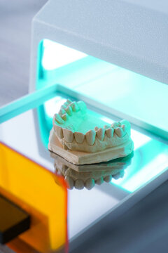 High angle of upper jaw dental cast model placed in light curing unit in modern laboratory