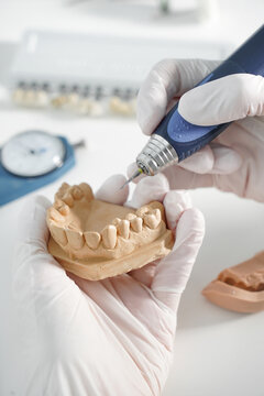 From above of crop anonymous dentist in medical gloves grinding dental prosthesis with professional tool while working in modern laboratory