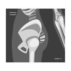 X-ray Film of Coxofemoral Joint Side View Vector Illustrated Image for Educational Purpose