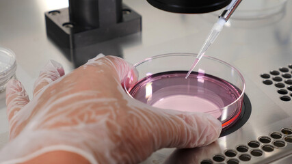 Close-up shot of IVF procedure. Embryologist in protective gloves dropping media from plastic test...