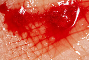 Close-up of blood from a wound on a human skin.