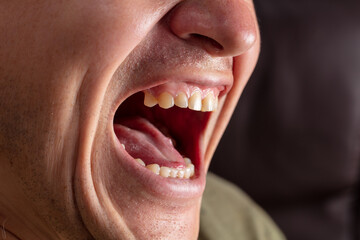 Close-up lips and mouth of a man screaming.