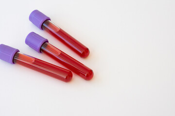 Test tubes made of glass with blood samples on white background.