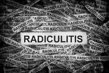 Radiculitis. Torn pieces of paper with the word Radiculitis. Concept Image. Black and white. Close up.