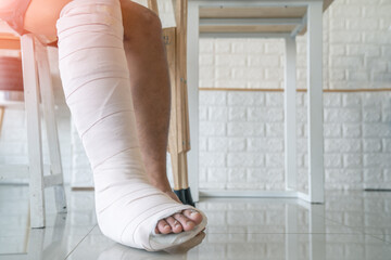 A man's leg was worn on a splint, injured by a broken bone and a staff,Put on a cast, A man with a...
