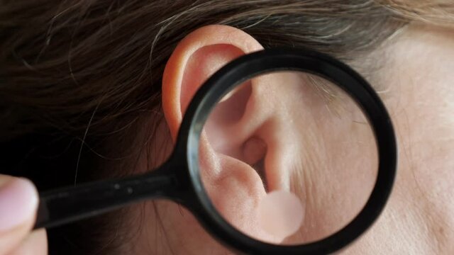 Dermatologist examines a large mole in the patient's ear using a magnifying glass.