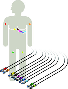 ECG wiring diagram showing 6+2+2 colour-coded sensors.