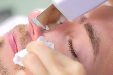 Cosmetologist woman making ultrasonic face cleaning procedure on nose for young man in clinic. Closeup client portrait and beautician's hands top view. Cosmetology salon. Beauty industry concept.