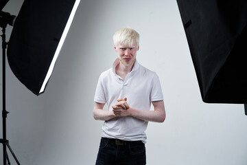 albinism albino man in studio dressed t-shirt isolated on a white background. abnormal deviations....