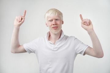 Fototapeta na wymiar albinism albino man in studio dressed t-shirt isolated on a white background. abnormal deviations. unusual appearance