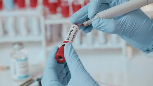 Coronavirus Covid 19 infected blood sample in sample tube in hand of scientist doctor biohazard protection clothing in coronavirus covid 19 research laboratory, Coronavirus Covid-19 vaccine research