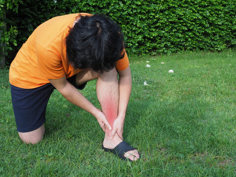 man people acute with ankle sprain with walking in garden.