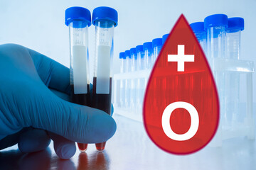 Blood test. Determination of blood group. Test tubes in the hands of a laboratory assistant and a...