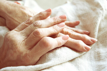 Hands of rheumatoid arthritis (1)