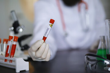 A scientist researcher in the laboratory is testing drugs for the treatment of viral pneumonia. Coronovirus blood test of infected patients. World pandemic.
