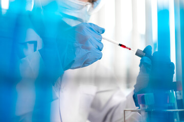 Professional doctors perform find virus tests from samples of blood tests to diagnose coronary...