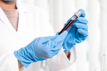 Professional doctors perform find virus tests from samples of blood tests to diagnose coronary virus infections analysis and sampling of infectious