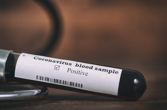 Coronavirus 2019-nCoV Blood Sample . Epidemic virus Respiratory Syndrome stock photo. Test tube with Blood Test (novel Coronavirus 2019 disease,COVID-19,nCoV)