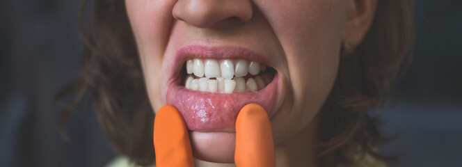 Woman in gloves shows her crooked teeth.