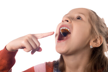 Little cute girl shows her orthodontic appliance on a white background