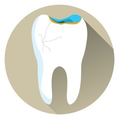 cracked tooth