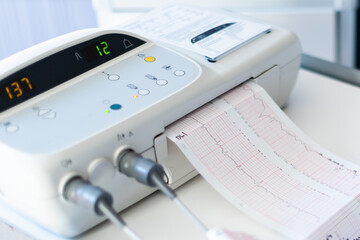 Cardiogram of the baby before birth