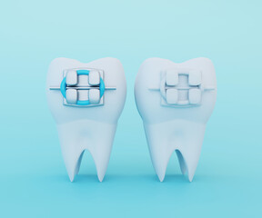 White Clear Tooth with Metal Braces and Tooth with Ceramic Braces. Comparison of braces and brace selection concept, 3d render
