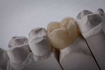 Dental Art, Smile design, Teeht