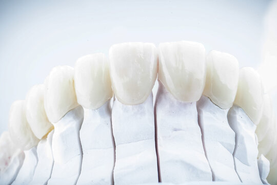 Dental Art, Smile design, Teeht