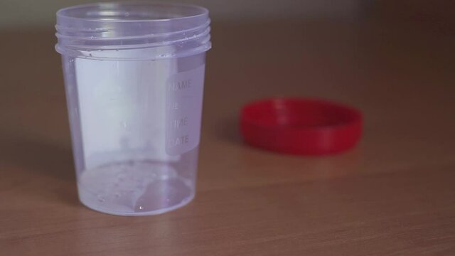 man with the analysis of semen. Sperm donation at the clinic. concept of artificial insemination.