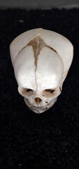 child skull newborn