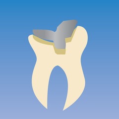 dental crown and tooth