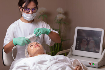 Lifting by ultrasound using a special cosmetology device. Smoothing wrinkles on the face with ultrasound