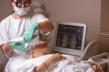 Lifting by ultrasound using a special cosmetology device. Smoothing wrinkles on the face with...