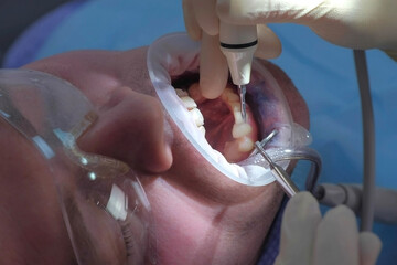 Man on ultrasound teeth brushing procedure in stomatology clinic. Oral hygiene. Doctor woman...