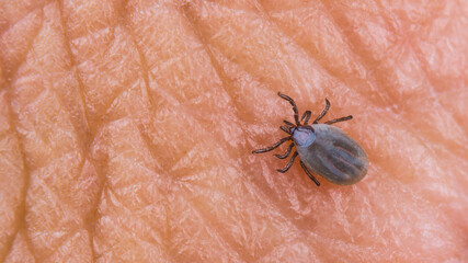 Small female deer tick on human skin texture. Ixodes ricinus or scapularis. Parasitic mite close-up. Fat body full of blood and visible hypostom piercing into epidermis. Encephalitis or Lyme disease.