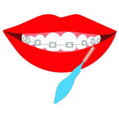 Installed braces on a woman's teeth and a brush for cleaning them. Stock vector illustration isolated on white background. Medical dental braces for an orthodontist and a special brush for cleaning