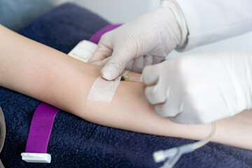 Doctor hand put intravenous(IV) injection on patient arm for drip medicine.