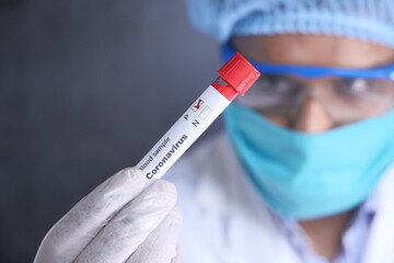 laboratory technician testing corona virus , COVID 19 test.