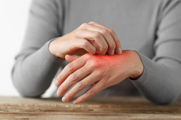 Rash and irritation on the skin of the hands, itching. Dermatological problems.