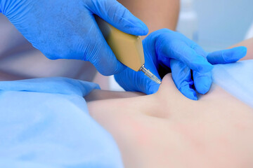 Doctor is making injection carbon dioxide in patient abdomen on carboxytherapy using special apparatus. Treatment and remove of skin tags and stretches. Cosmetologist on mesotherapy, ozone therapy.