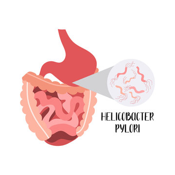 Human digestive system. Gut, small and large intestine. Helicobacter pylori. Vector flat cartoon illustration. Perfect for banner, medical brochure, flyer
