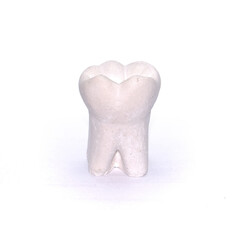 Plaster model of tooth